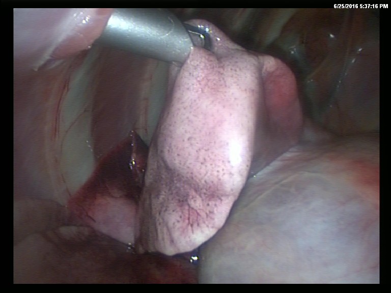 surgery-6